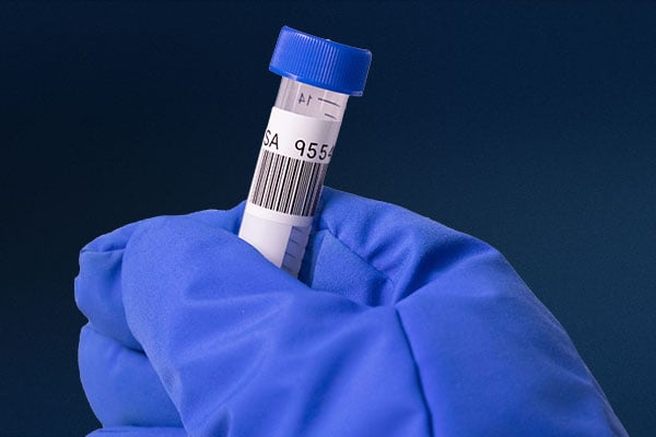 Tech holding a frozen vial with a Brady cryogenic label. 