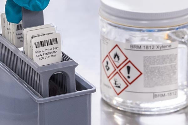 Gloved hand holding laboratory sample slides.